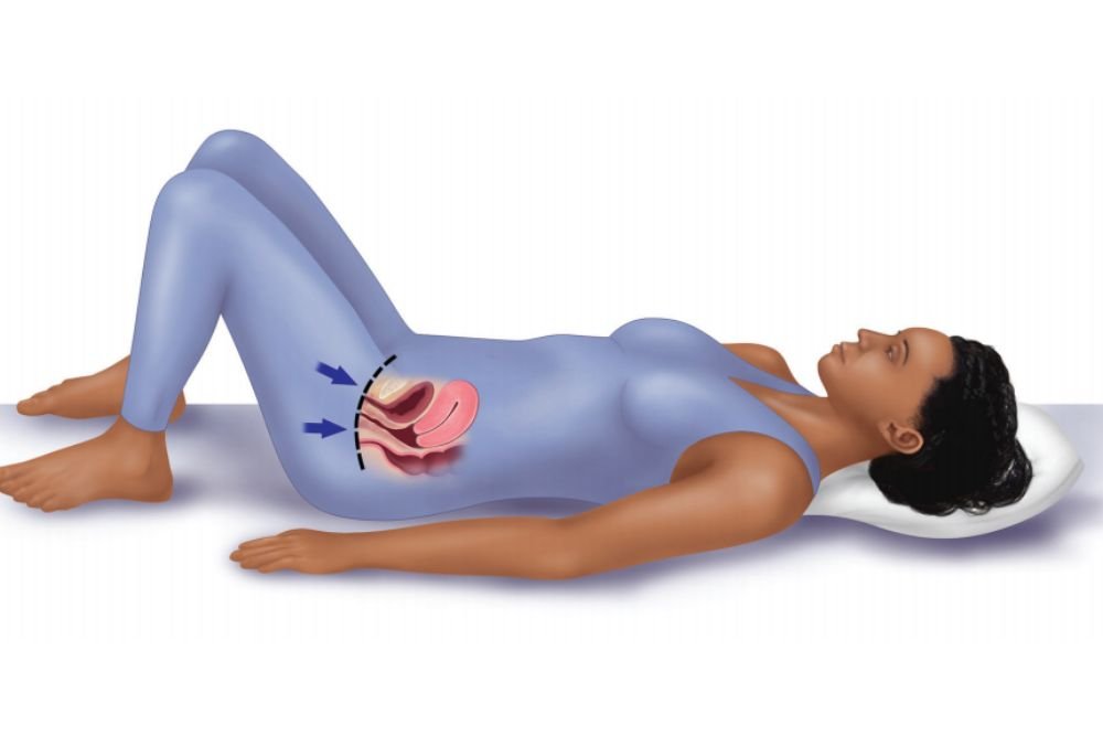 Kegel Exercise for Ladies Secrets to Boosting Strength