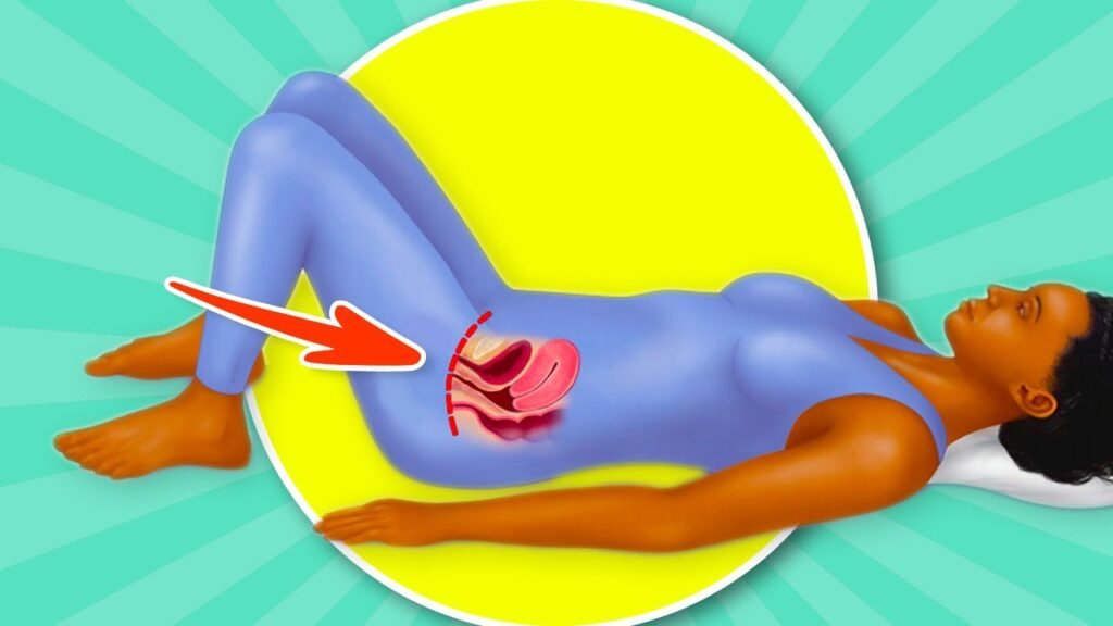 Kegel What Is: A guide to understanding its benefits